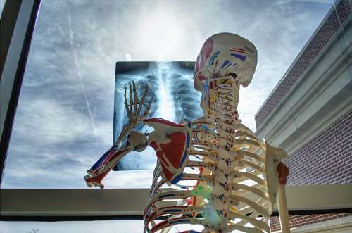 radiografia radiografia