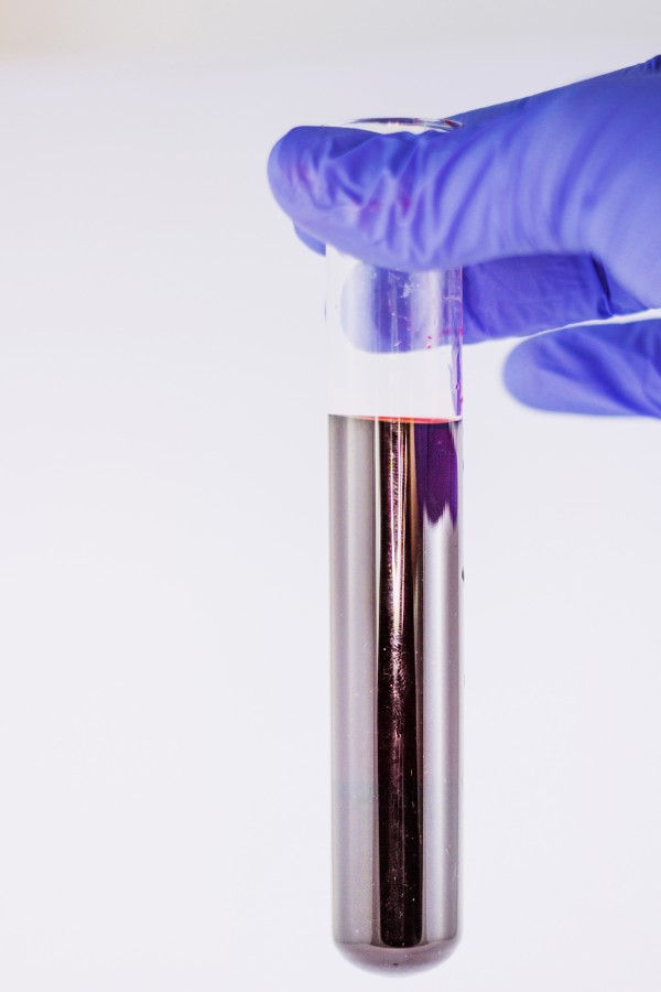 laboratório, tubo de ensaio, tubo, vidro, luva, luva de látex, ciência, tecnologia, científica, sangue, análise, medicina, mãos,